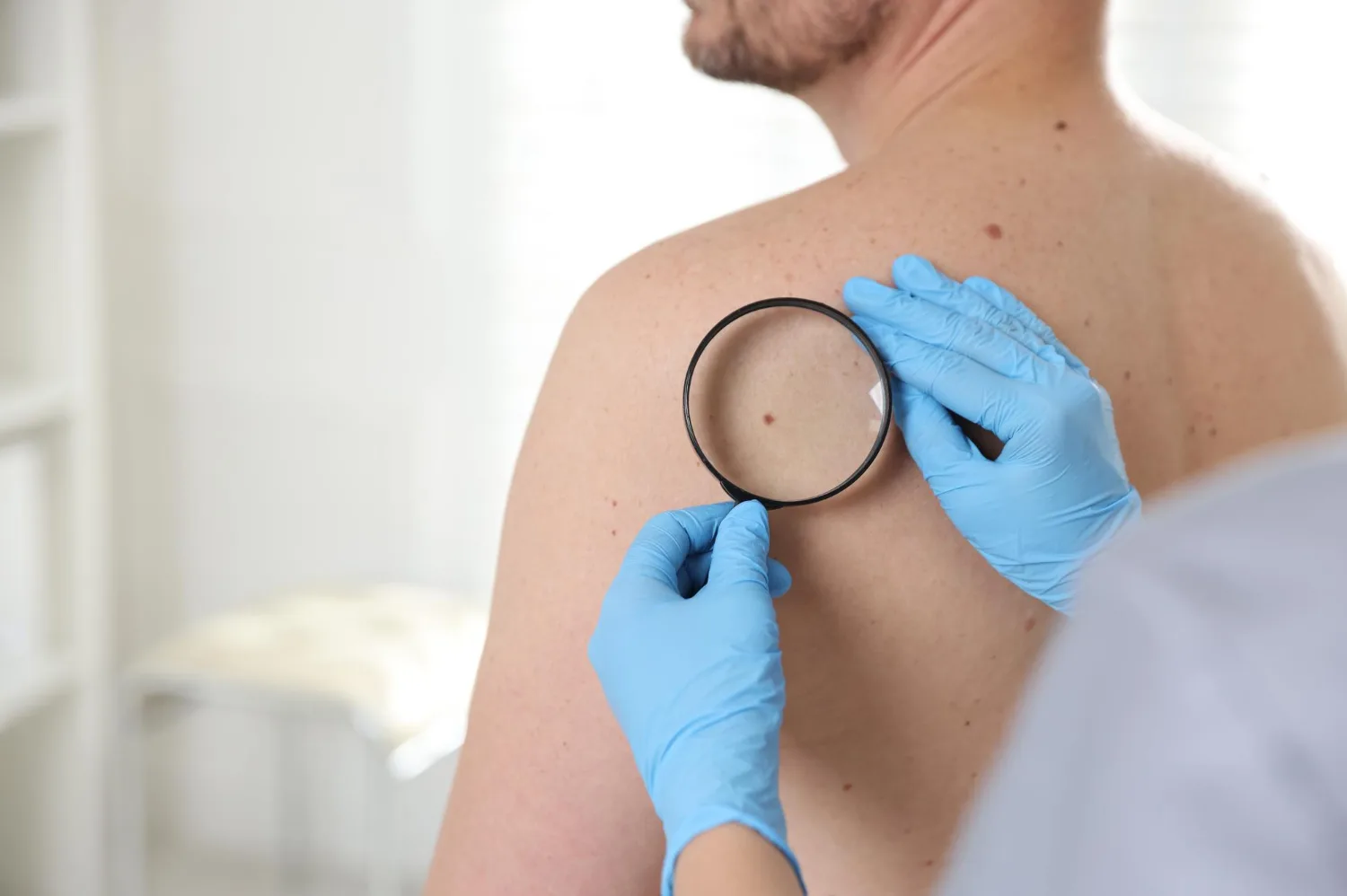 Especialista en Cáncer de Piel en Naucalpan y Tlalnepantla | Dr. Salvador Alonso Gutiérrez Ávila